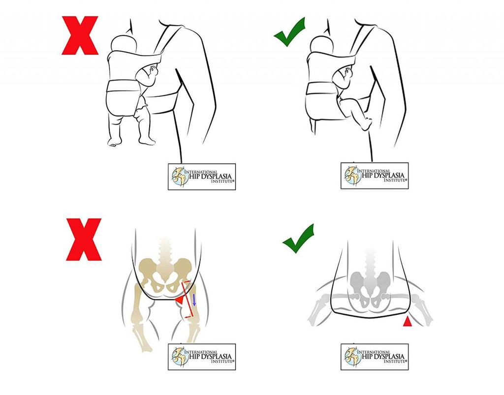 Czym się różni nosidło ergonomiczne od&nbsp;wisiadła?